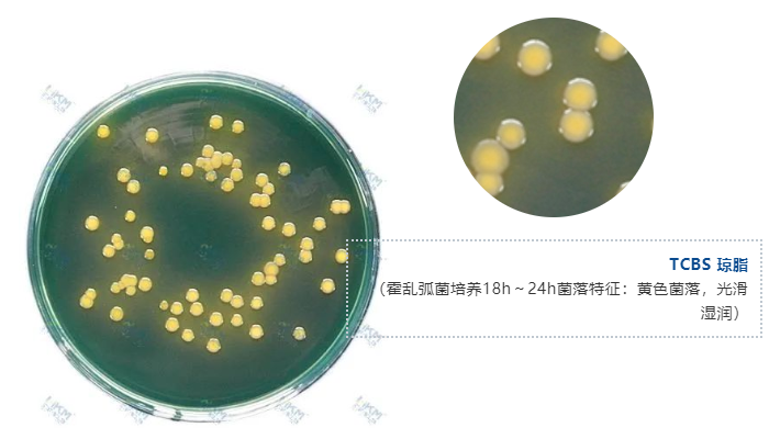 TCBS 瓊脂（霍亂弧菌培養(yǎng)18h～24h菌落特征：黃色菌落，光滑濕潤）