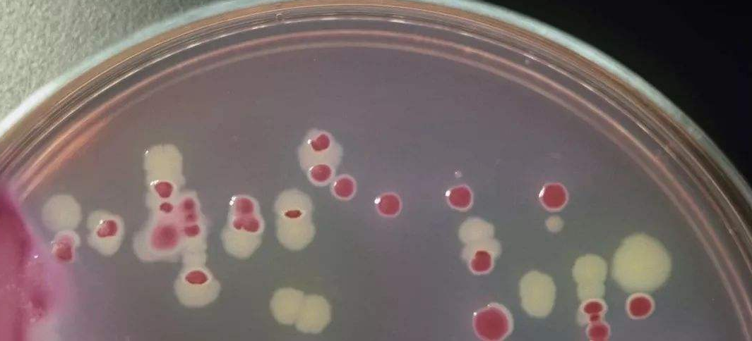 加TTC檢測菌落總數(shù)